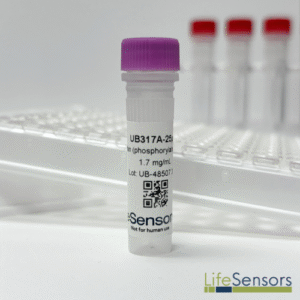 UB317A: Parkin (Phosphorylated)